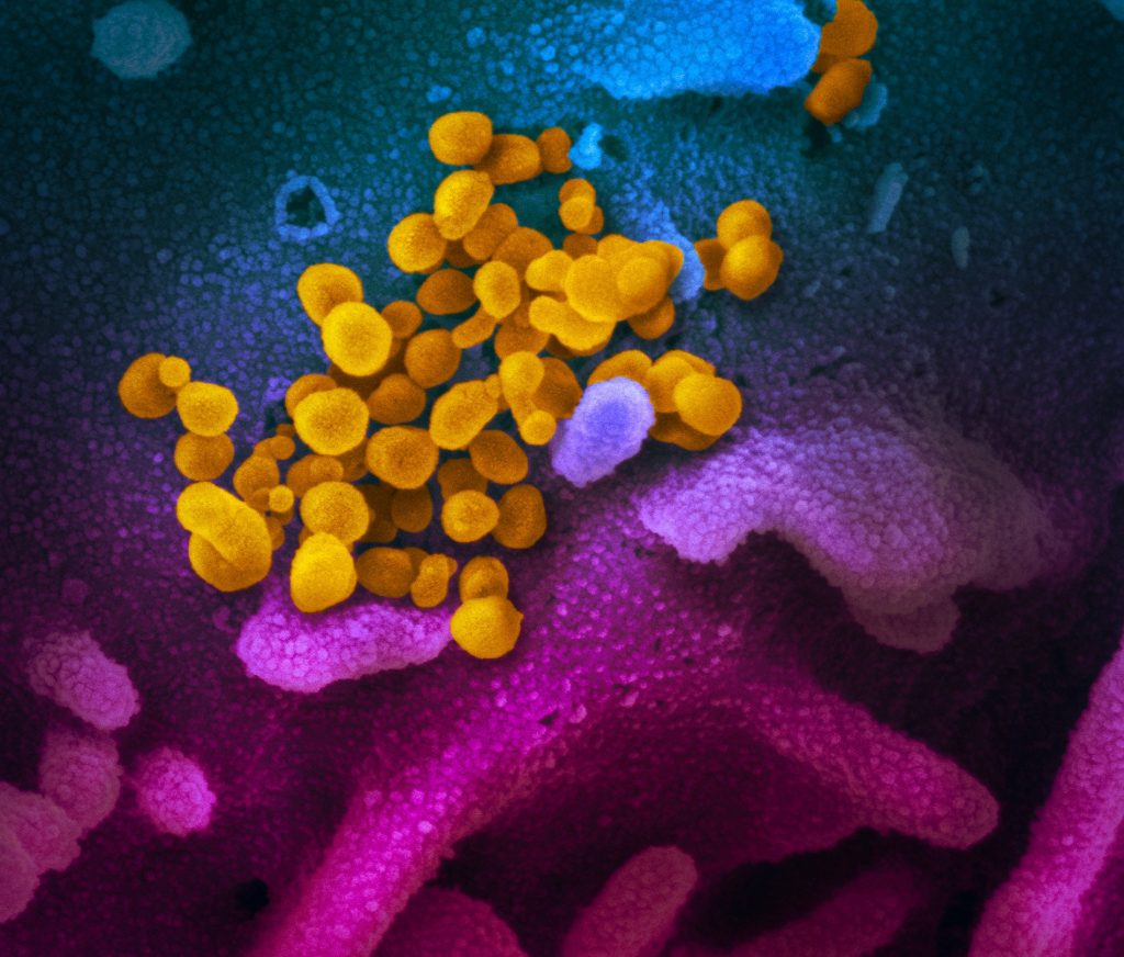 Koronavirüsün elektron mikroskobu ile çekilmiş gerçek fotoğrafı